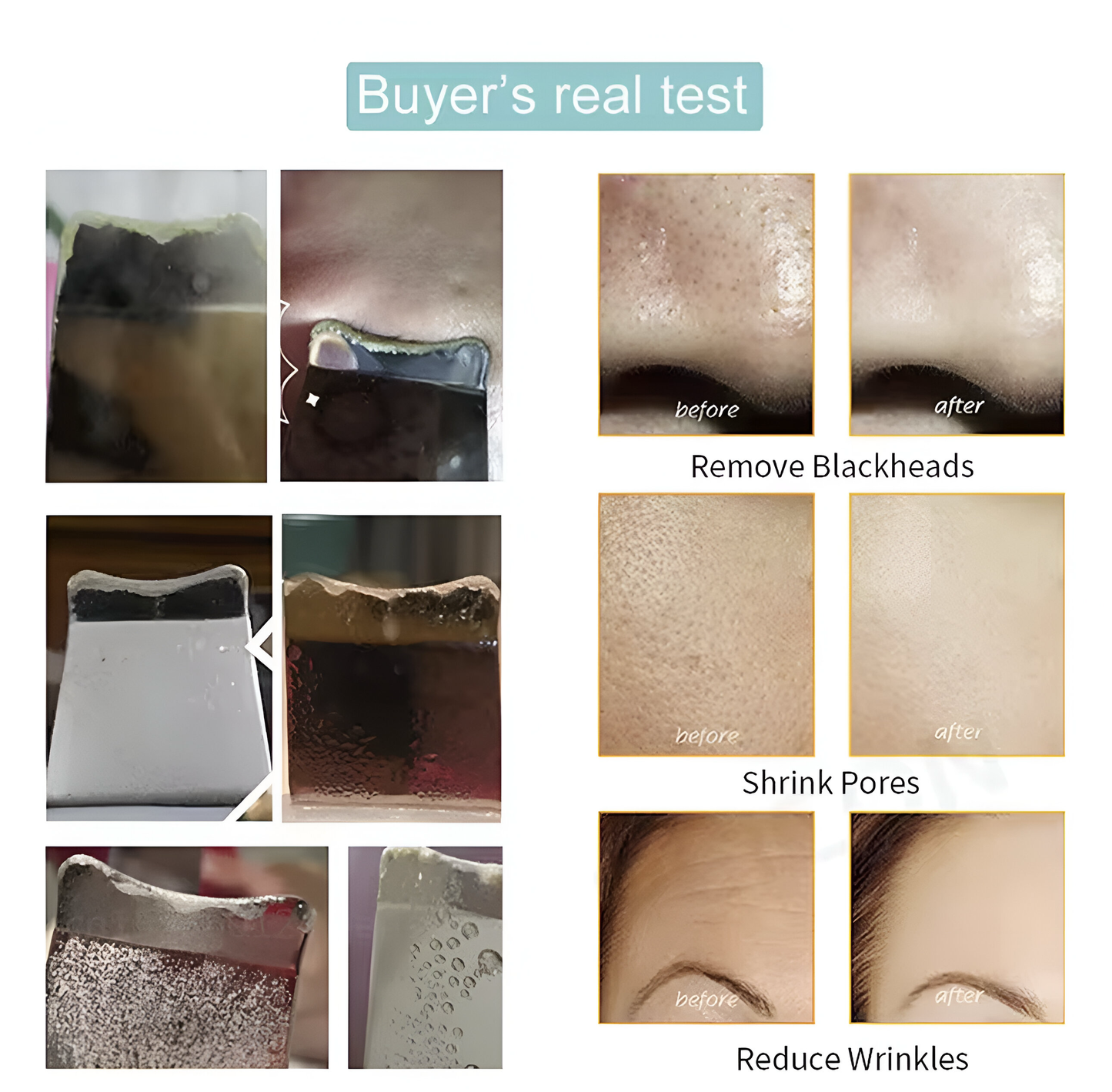 PoreWave™ - Ultrasonic Blackhead Remover