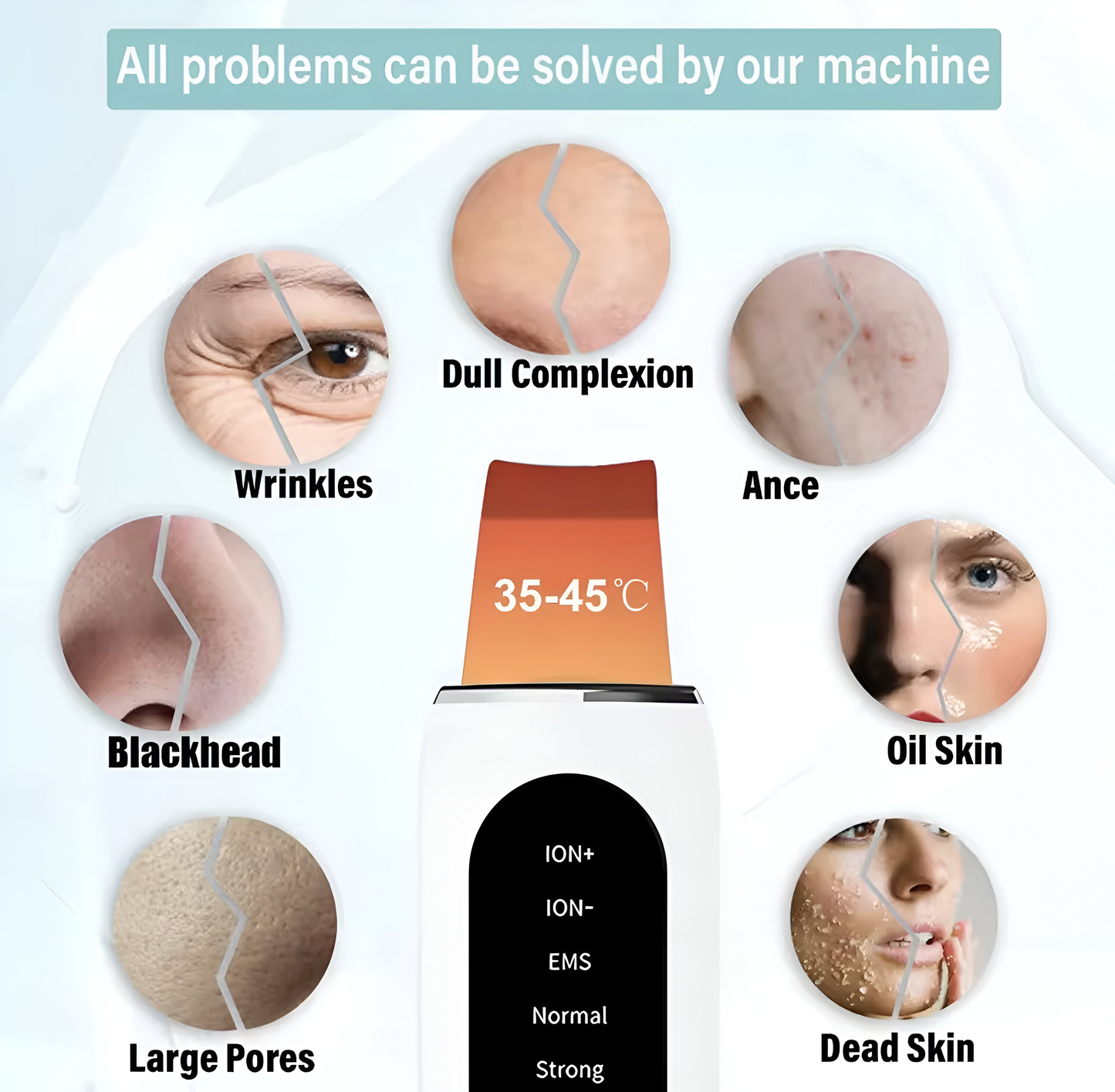 PoreWave™ - Ultrasonic Blackhead Remover