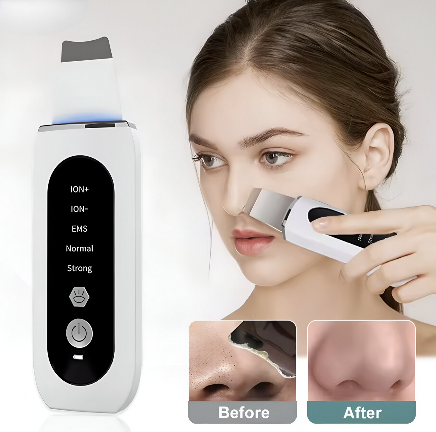 PoreWave™ - Ultrasonic Blackhead Remover