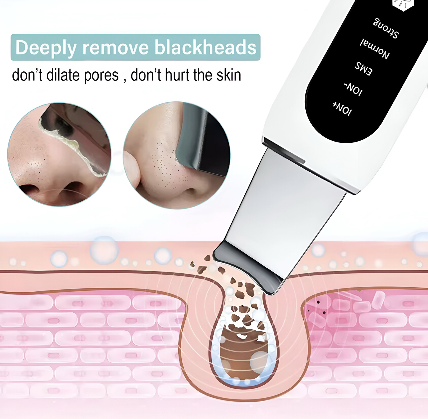 PoreWave™ - Ultrasonic Blackhead Remover