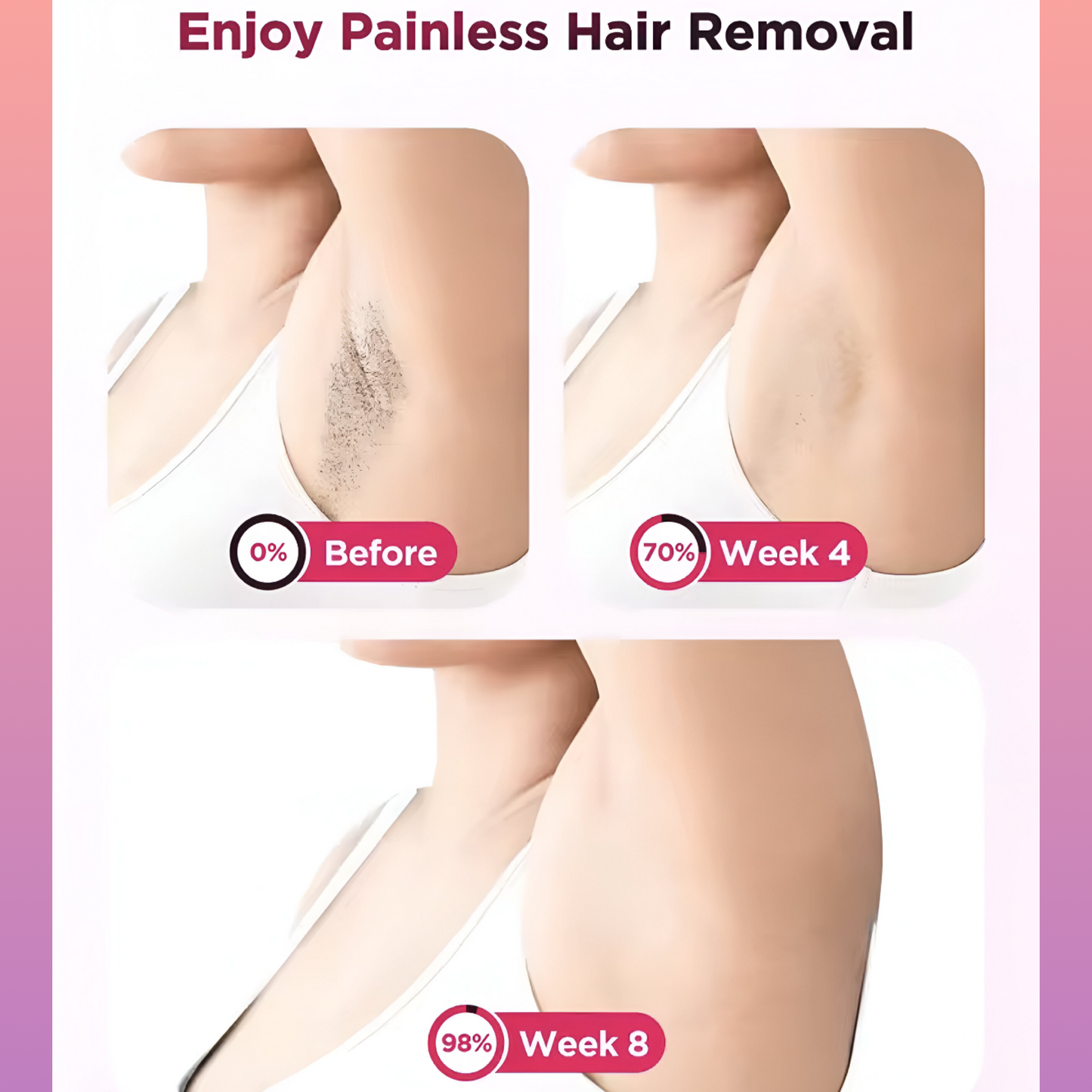 SilkFreeze™ - IPL Laser Hair Remover