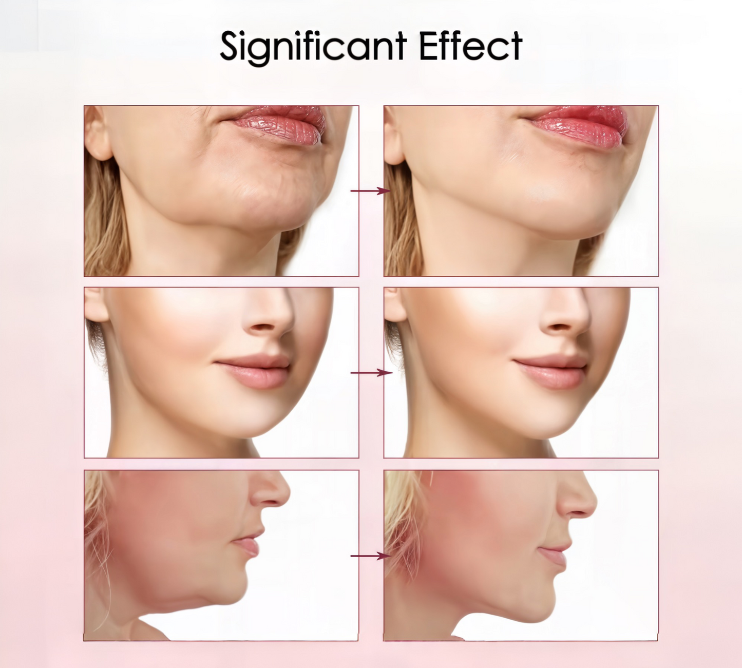 VGloW™ - EMS Compact Lifting V-Face Massager