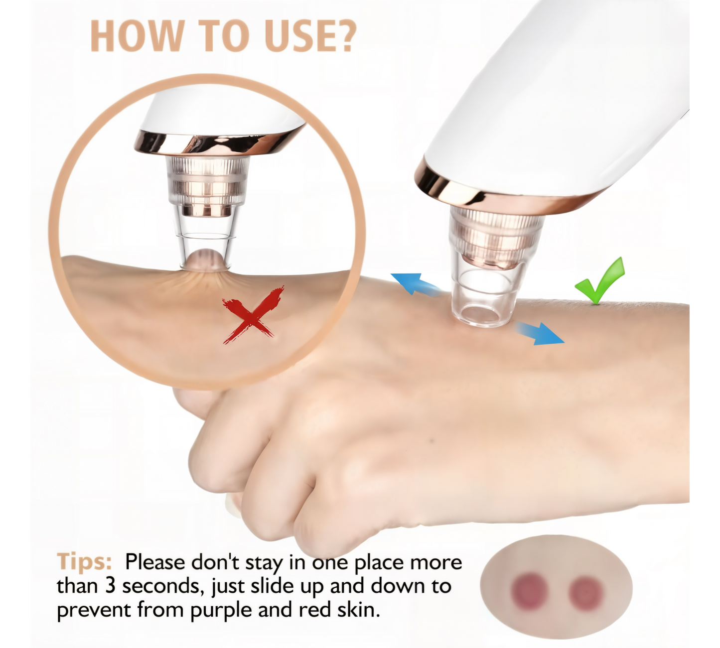 PoreVac ProM™- Rechargeable Pore Vacuum Cleanser