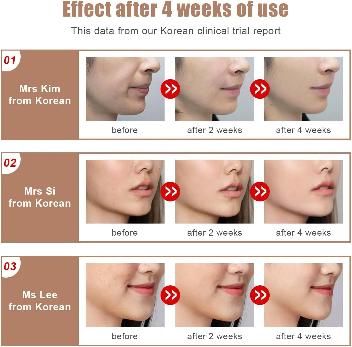 Microcurrent Face Lifting Massager for Skin Rejuvenation